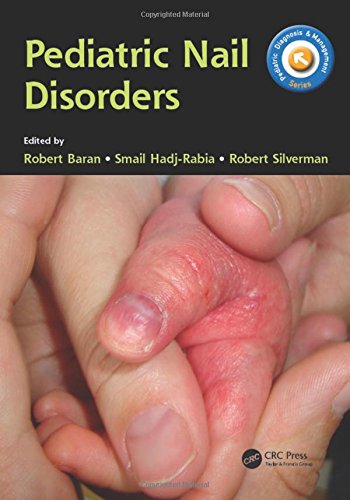 Pediatric Nail Disorders 2016