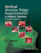 Vertical Alveolar Ridge Augmentation in Implant Dentistry: A Surgical Manual 2016