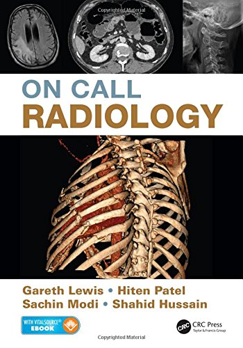On Call Radiology 2015