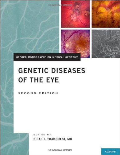 Genetic Diseases of the Eye 2012
