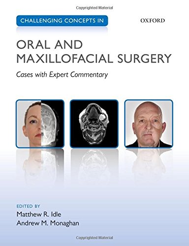 Challenging Concepts in Oral and Maxillofacial Surgery: Cases with Expert Commentary 2016