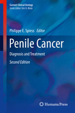 Penile Cancer: Diagnosis and Treatment 2016