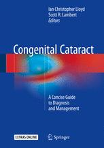 Congenital Cataract: A Concise Guide to Diagnosis and Management 2016