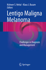 Lentigo Maligna Melanoma: Challenges in Diagnosis and Management 2016