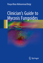 Clinician's Guide to Mycosis Fungoides 2017