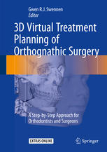 3D Virtual Treatment Planning of Orthognathic Surgery: A Step-by-Step Approach for Orthodontists and Surgeons 2016