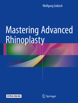 Mastering Advanced Rhinoplasty 2017