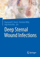 Deep Sternal Wound Infections 2017