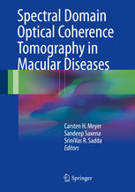 Spectral Domain Optical Coherence Tomography in Macular Diseases 2016