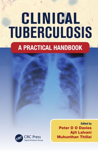 Clinical Tuberculosis: A Practical Handbook 2015