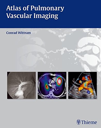 Atlas of Pulmonary Vascular Imaging 2010