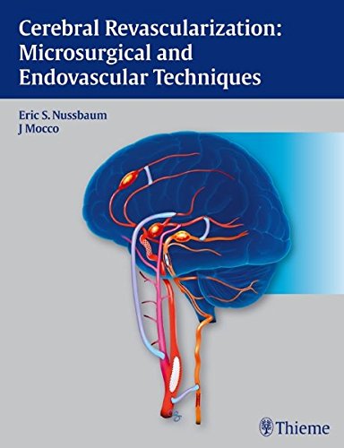 Cerebral Revascularization: Microsurgical and Endovascular Techniques 2011