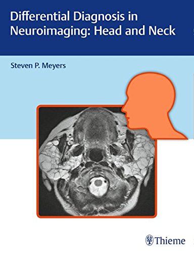 Differential Diagnosis in Neuroimaging: Head and Neck 2016