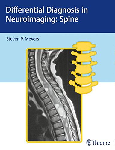 Differential Diagnosis in Neuroimaging: Spine 2016