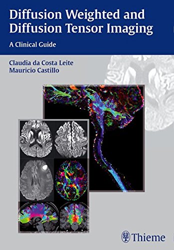 Diffusion Weighted and Diffusion Tensor Imaging: A Clinical Guide 2016