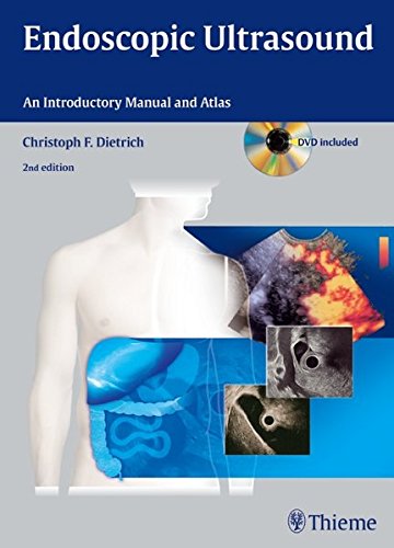 Endoscopic Ultrasound: An Introductory Manual and Atlas 2011