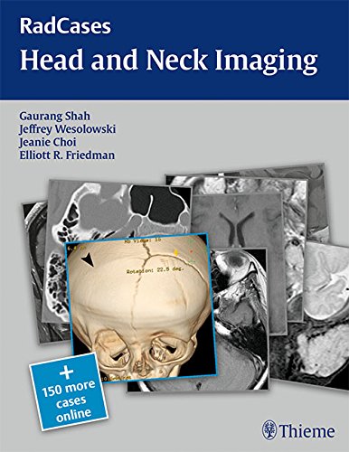 RadCases Head and Neck Imaging 2016