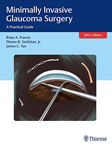 Minimally Invasive Glaucoma Surgery: A Practical Guide 2016