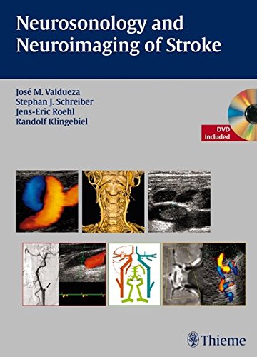 Neurosonology and Neuroimaging of Stroke 2008