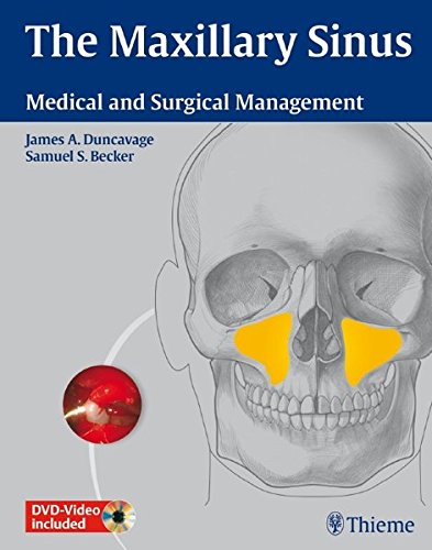 The Maxillary Sinus: Medical and Surgical Management 2011