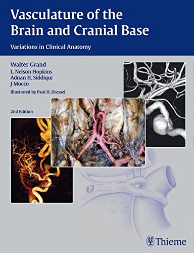 Vasculature of the Brain and Cranial Base: Variations in Clinical Anatomy 2016