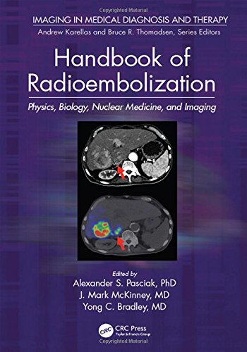 Handbook of Radioembolization: Physics, Biology, Nuclear Medicine, and Imaging 2016