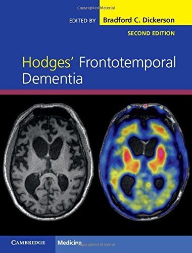 Hodges' Frontotemporal Dementia 2016