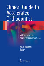 Clinical Guide to Accelerated Orthodontics: With a Focus on Micro-Osteoperforations 2017