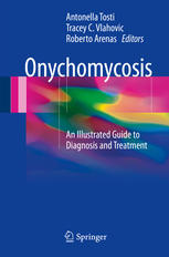 Onychomycosis: An Illustrated Guide to Diagnosis and Treatment 2017