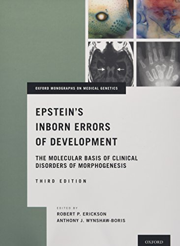 Epstein's Inborn Errors of Development: The Molecular Basis of Clinical Disorders of Morphogenesis 2016