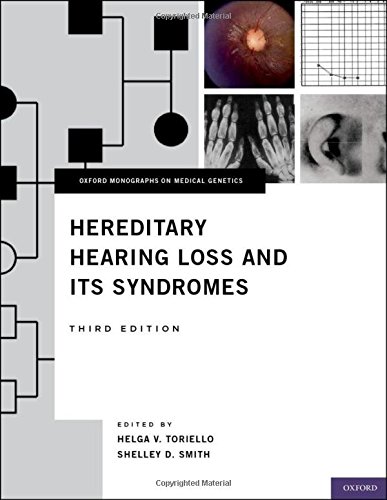 Hereditary Hearing Loss and Its Syndromes 2013