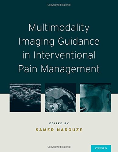 Multimodality Imaging Guidance in Interventional Pain Management 2016