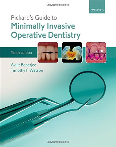 Pickard's Guide to Minimally Invasive Operative Dentistry 2015