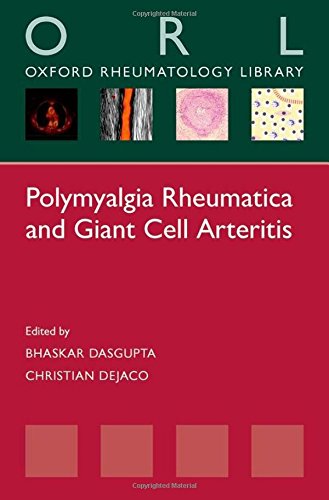 پلیمیالژیا روماتیکا و آرتریت سلول غول پیکر