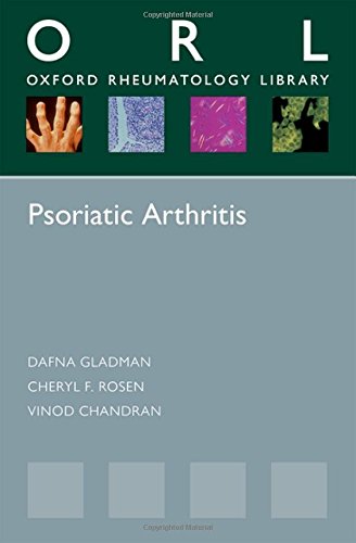 Psoriatic Arthritis 2013