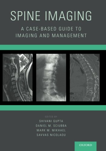 Spine Imaging: A Case-Based Guide to Imaging and Management 2015