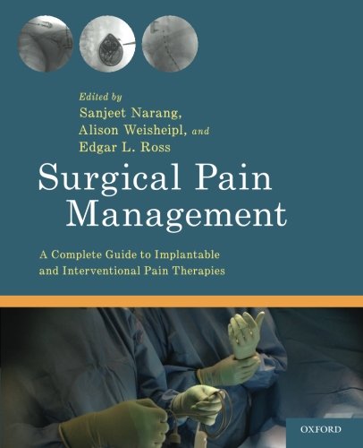 Surgical Pain Management: A Complete Guide to Implantable and Interventional Pain Therapies 2015