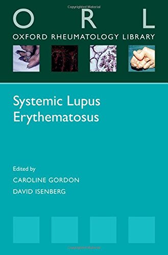 Systemic Lupus Erythematosus 2016