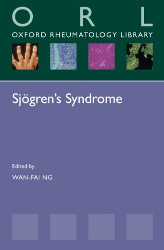 Sjogren's Syndrome 2016