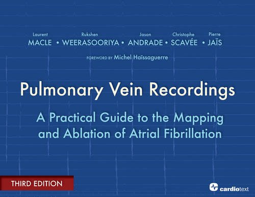 Pulmonary Vein Recordings: A Practical Guide to the Mapping and Ablation of Atrial Fibrillation 2014