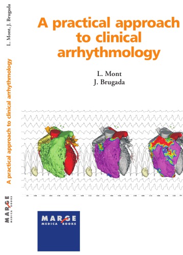A practical approach to clinical arrhythmology 2010