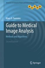 Guide to Medical Image Analysis: Methods and Algorithms 2017