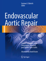 Endovascular Aortic Repair: Current Techniques with Fenestrated, Branched and Parallel Stent-Grafts 2017