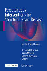 Percutaneous Interventions for Structural Heart Disease: An Illustrated Guide 2017