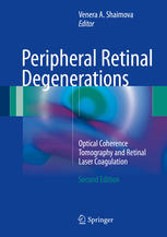 Peripheral Retinal Degenerations: Optical Coherence Tomography and Retinal Laser Coagulation 2017