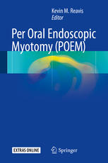 Per Oral Endoscopic Myotomy (POEM) 2017