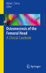 Osteonecrosis of the Femoral Head: A Clinical Casebook 2017