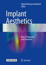 Implant Aesthetics: Keys to Diagnosis and Treatment 2017