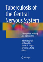 Tuberculosis of the Central Nervous System: Pathogenesis, Imaging, and Management 2017