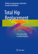 Total Hip Replacement: Case Series from a Leading Registry 2017